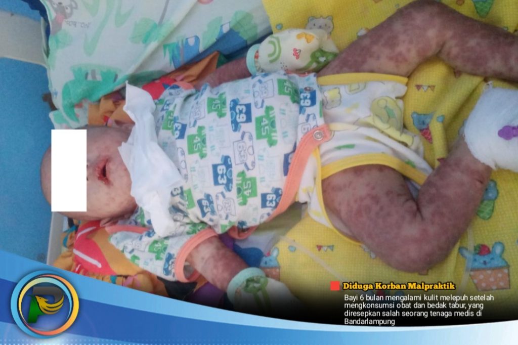 Bayi RAP Terpaksa Nyusu Pakai Pipet, Bidan Hanya Disanksi Teguran Tertulis