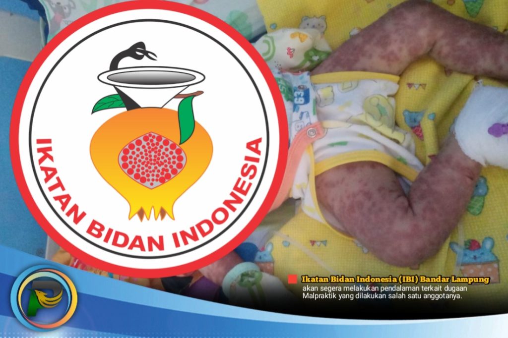 Terkait Dugaan Malpraktik, Bidan Berkilah, IBI Segera Selidiki